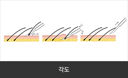 각도